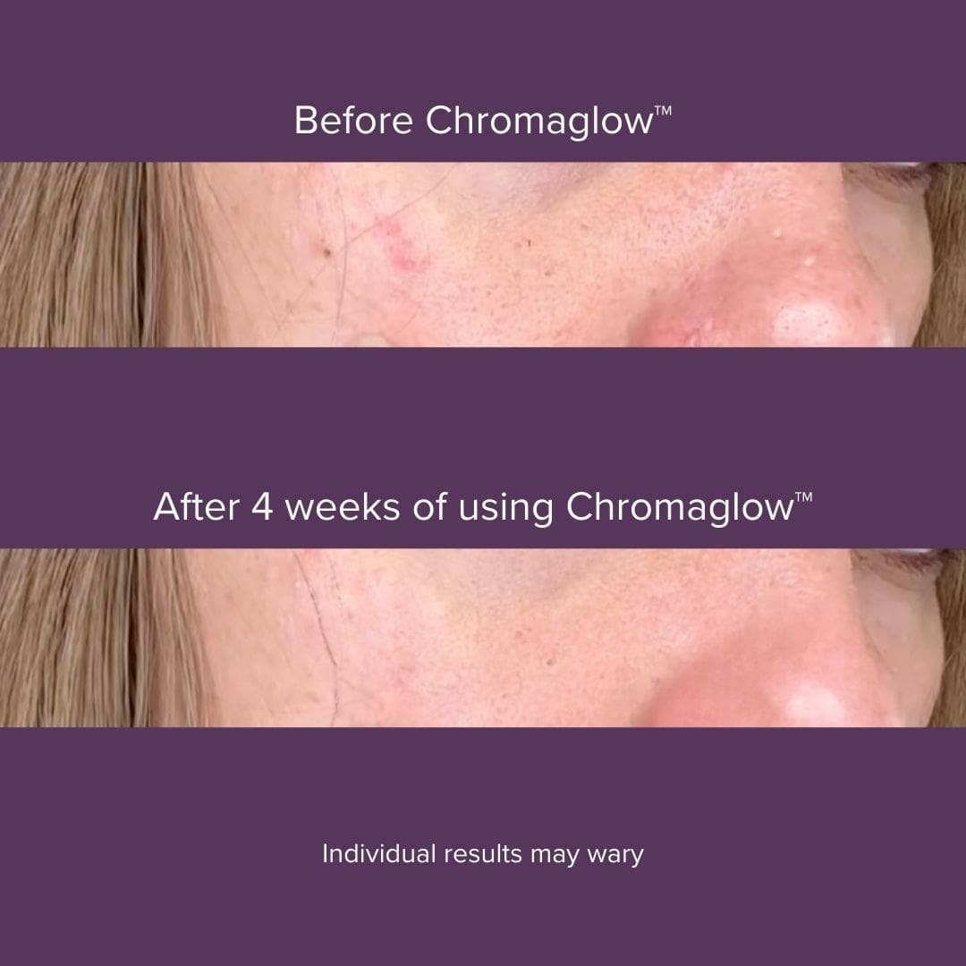 Chromaglow™ 7 Color Skincare Wand