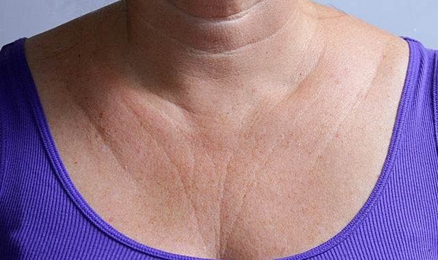 NOUVEAU! Silc Skin Decollete &amp; Collete (Neck) Anti-Wrinkle Pads