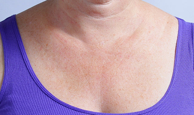 NOUVEAU! Silc Skin Decollete & Collete (Neck) Anti-Wrinkle Pads